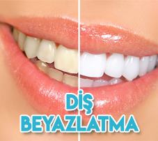 beyazlatma